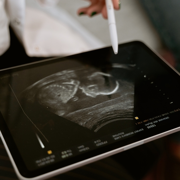 Doctor looking at an ultrasound scan